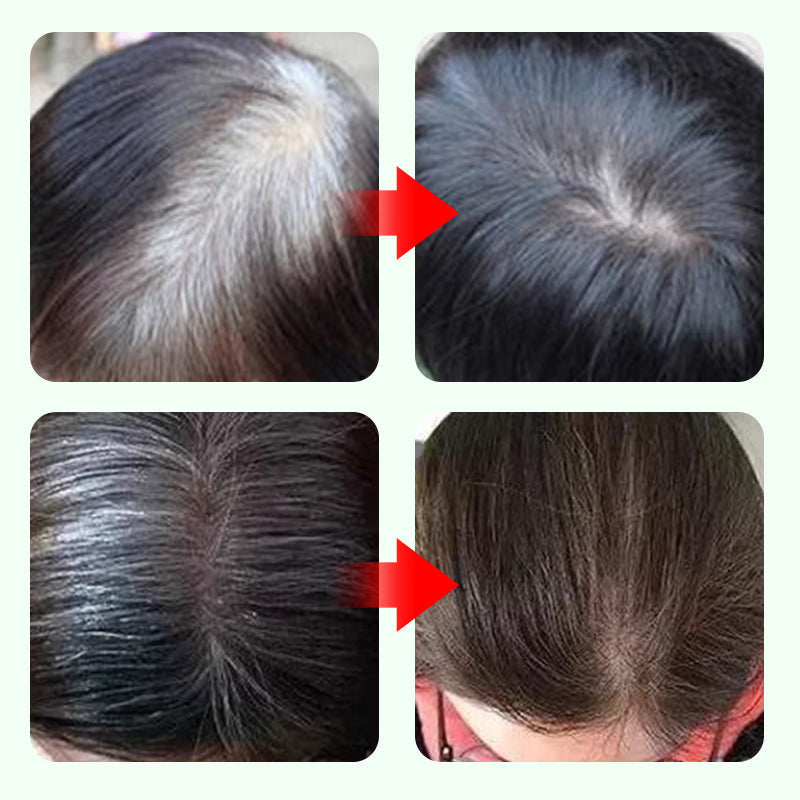 ✏️ BUY 2 GET 3! ✨ Anti-Root Pen 3-Color Menu - 10-Second Coverage with Waterproof Formula for Instant Rejuvenation 🌟🧴